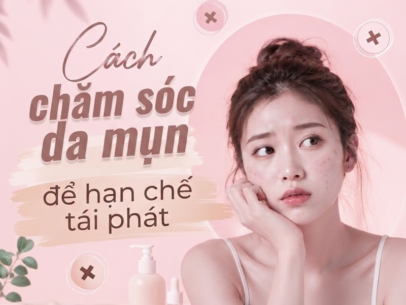 Hướng dẫn cách chăm sóc da mụn để hạn chế tái phát hiệu quả